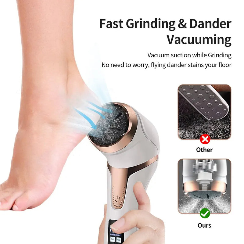 Electric Foot Callus Remover